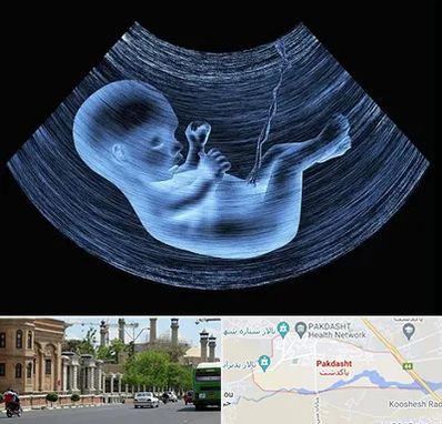 دکتر متخصص غربال گری در پاکدشت