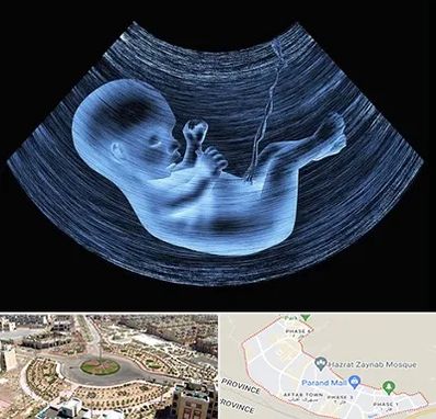 دکتر متخصص غربال گری در پرند