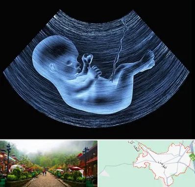 دکتر متخصص غربال گری در فومن