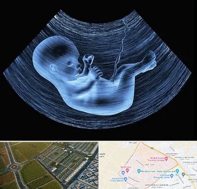 دکتر متخصص غربال گری در الهیه مشهد