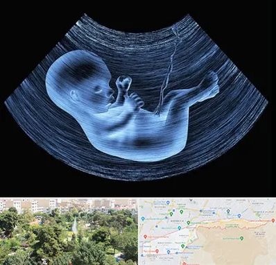 دکتر متخصص غربال گری در منطقه 13 تهران