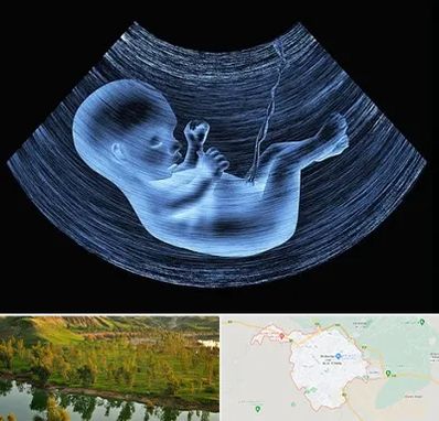 دکتر متخصص غربال گری در بهبهان