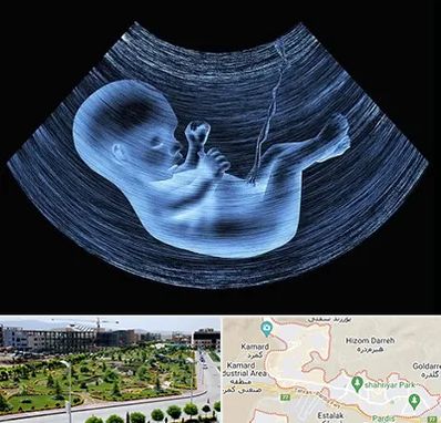 دکتر متخصص غربال گری در پردیس