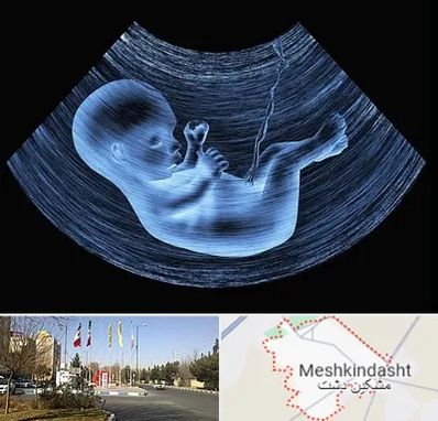 دکتر متخصص غربال گری در مشکین دشت