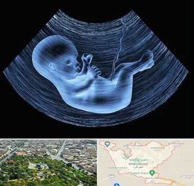 دکتر متخصص غربال گری در شهرکرد