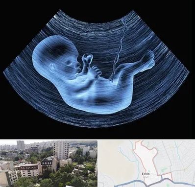 دکتر متخصص غربال گری در اوین