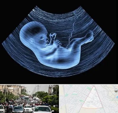 دکتر متخصص غربال گری در سیدی مشهد