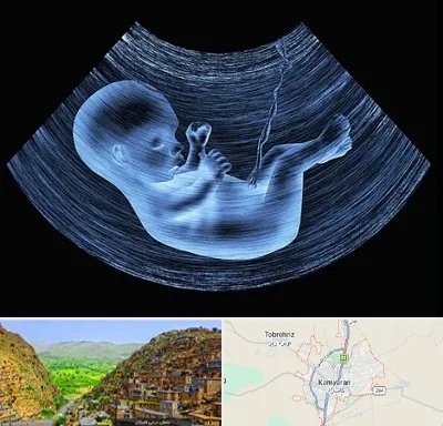 دکتر متخصص غربال گری در کامیاران