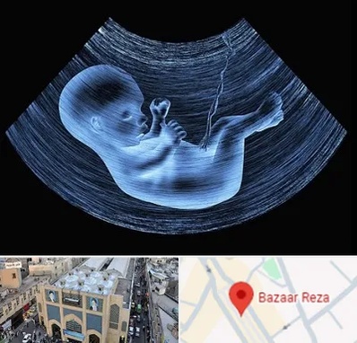 دکتر متخصص غربال گری در بازار رضا مشهد