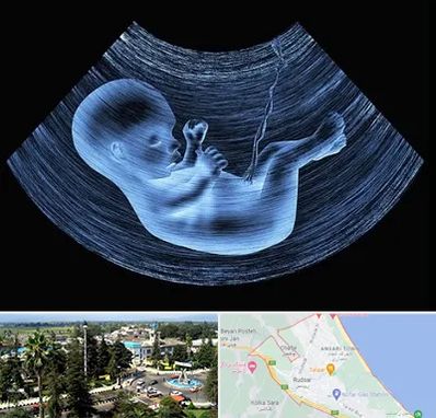 دکتر متخصص غربال گری در رودسر