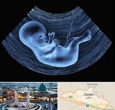 دکتر متخصص غربال گری در زنجان