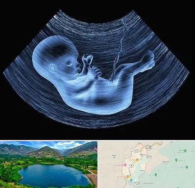 دکتر متخصص غربال گری در رودبار