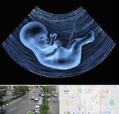 دکتر متخصص غربال گری در ستارخان 