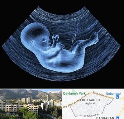 دکتر متخصص غربال گری در اختیاریه 