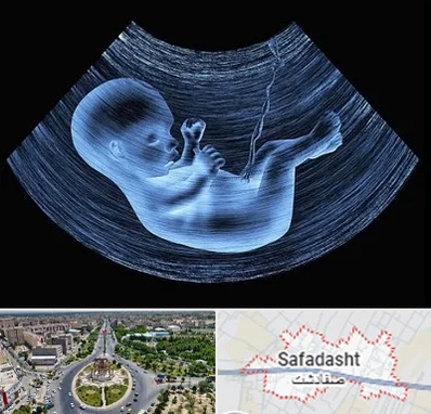 دکتر متخصص غربال گری در صفادشت