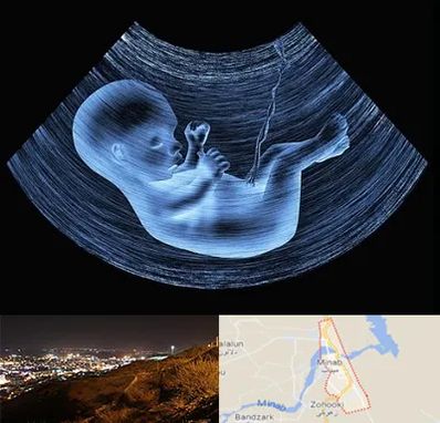 دکتر متخصص غربال گری در میناب