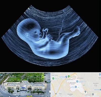 دکتر متخصص غربال گری در نسیم شهر