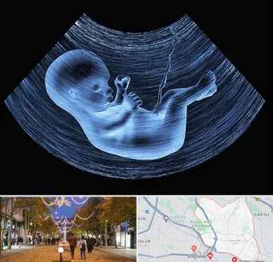 دکتر متخصص غربال گری در ولیعصر ارومیه