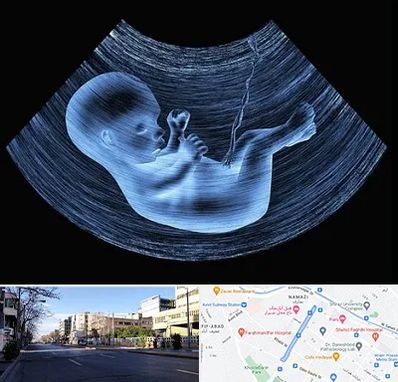 دکتر متخصص غربال گری در خیابان ملاصدرا شیراز