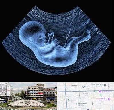 دکتر متخصص غربال گری در مرکز تهران