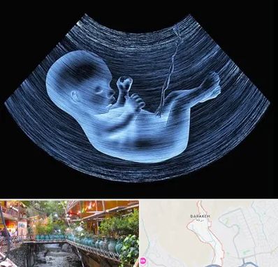 دکتر متخصص غربال گری در درکه