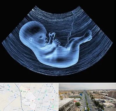 دکتر متخصص غربال گری در حصارک کرج