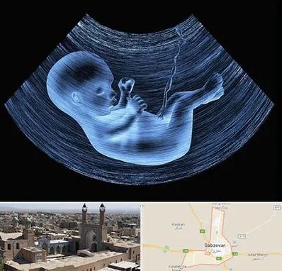 دکتر متخصص غربال گری در سبزوار