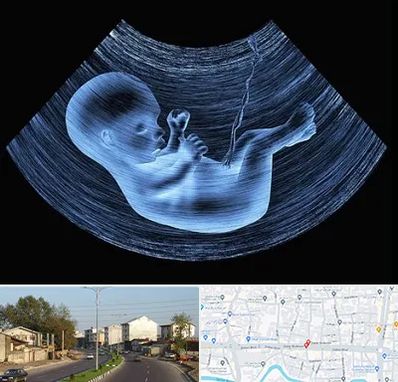 دکتر متخصص غربال گری در ضیابری رشت