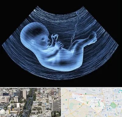 دکتر متخصص غربال گری در منطقه 18 تهران