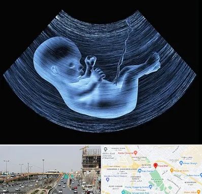 دکتر متخصص غربال گری در بلوار توس مشهد