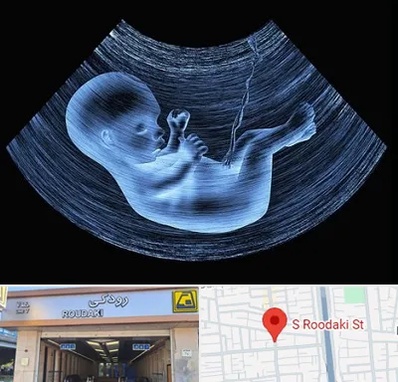 دکتر متخصص غربال گری در رودکی