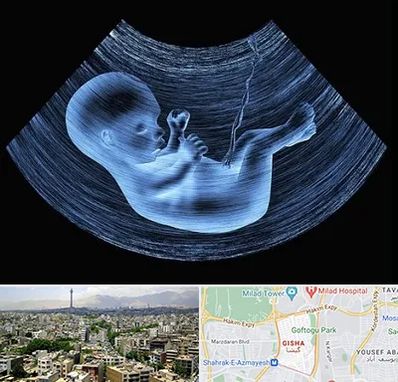 دکتر متخصص غربال گری در گیشا 