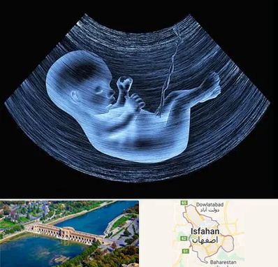 دکتر متخصص غربال گری در اصفهان