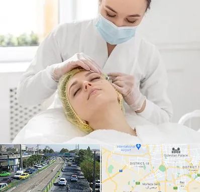 کلینیک زیبایی در جنوب تهران