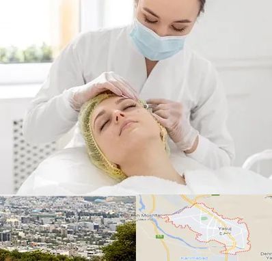 کلینیک زیبایی در یاسوج
