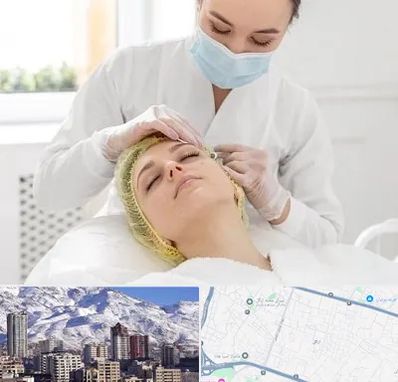 کلینیک زیبایی در ازگل