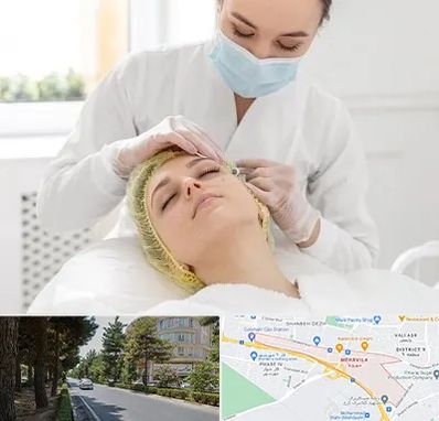کلینیک زیبایی در مهرویلا کرج