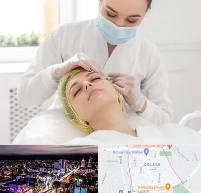 کلینیک زیبایی در گلسار رشت