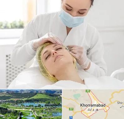 کلینیک زیبایی در خرم آباد