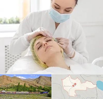 کلینیک زیبایی در خاش