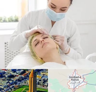 کلینیک زیبایی در گنبد کاووس