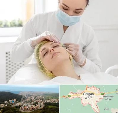کلینیک زیبایی در گرگان