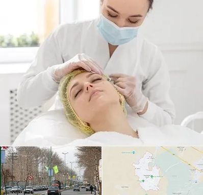 کلینیک زیبایی در نظرآباد کرج