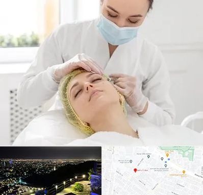 کلینیک زیبایی در هفت تیر مشهد