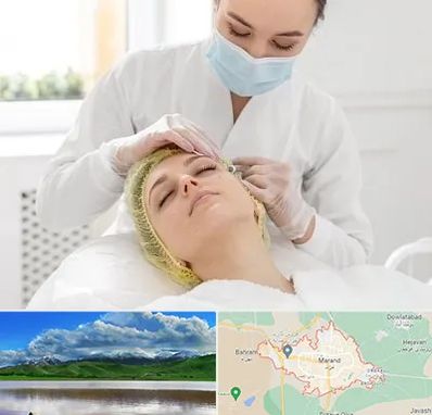 کلینیک زیبایی در مرند
