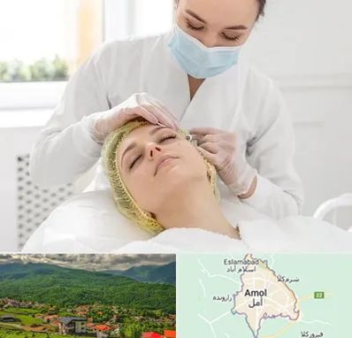 کلینیک زیبایی در آمل