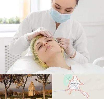 کلینیک زیبایی در تویسرکان