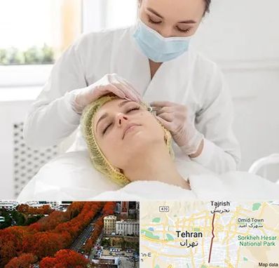 کلینیک زیبایی در ولیعصر