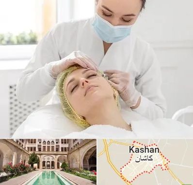 کلینیک زیبایی در کاشان