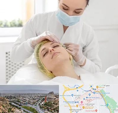کلینیک زیبایی در معالی آباد شیراز